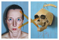 hephaiste! take up thy stethoscope and walk! (II) René Schoemakers -